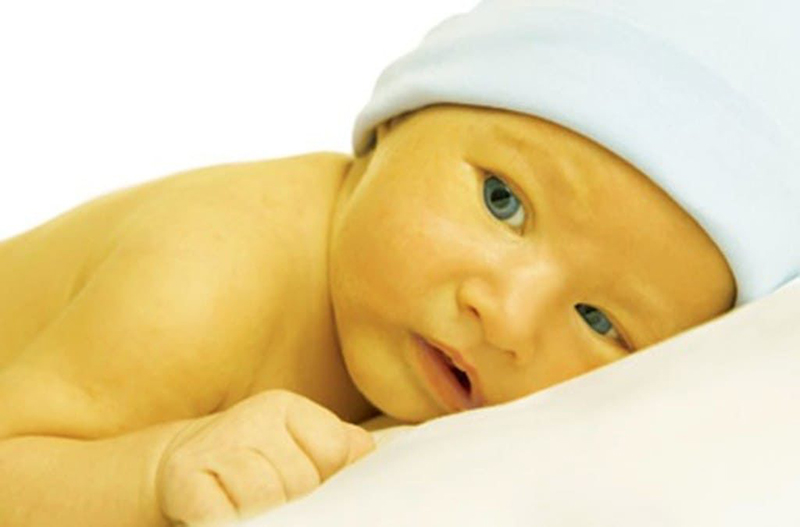 Hình ảnh vàng da ở trẻ sơ sinh