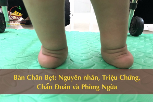 Bàn Chân Bẹt: Nguyên nhân, Triệu Chứng, Chẩn Đoán và Phòng Ngừa