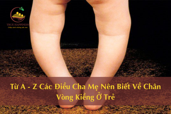 Từ A - Z Các Điều Cha Mẹ Nên Biết Về Chân Vòng Kiềng Ở Trẻ