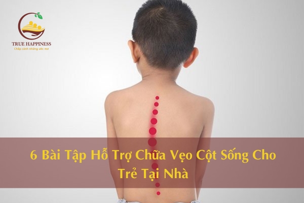 6 Bài Tập Hỗ Trợ Chữa Vẹo Cột Sống Cho Trẻ Tại Nhà