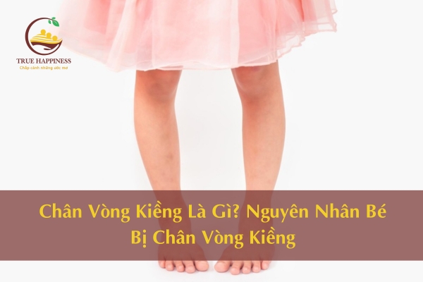 Chân Vòng Kiềng Là Gì? Nguyên Nhân Bé Bị Chân Vòng Kiềng