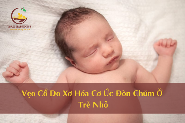 Vẹo Cổ Do Xơ Hóa Cơ Ức Đòn Chũm Ở Trẻ Nhỏ